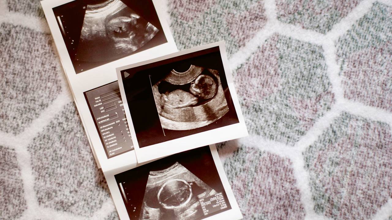 Υπολειπόμενη ανάπτυξη εμβρύου – Τι σημαίνει όταν είναι μικρό το έμβρυο;